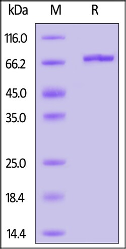 ACROBiosystems Human Alpha-fetoprotein, His Tag, Quantity: Each of 1
