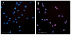 Biolegend&nbsp;Alexa Fluor 647 anti-GATA1 [P84F5]; Isotype: Mouse IgG2b, κ; Reactivity: Human; Apps: ICFC, ICC; Size: 100 μg