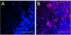 Biolegend&nbsp;Alexa Fluor 647 anti-Glutamic Acid Decarboxylase (GAD65/GAD2) [N-GAD65]; Isotype: Mouse IgG1, κ; Reactivity: Human, Mouse, Rat; Apps: IHC-P; Size: 100 μg