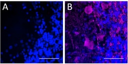 Biolegend&nbsp;Alexa Fluor 647 anti-Glutamic Acid Decarboxylase (GAD65/GAD2) [N-GAD65]; Isotype: Mouse IgG1, κ; Reactivity: Human, Mouse, Rat; Apps: IHC-P; Size: 25 μg