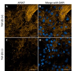 Biolegend&nbsp;Alexa Fluor 647 anti-α Smooth Muscle Actin [1A4]; Isotype: Mouse IgG2a, κ; Reactivity: Human, Mouse; Apps: IHC-P, ICC; Size: 25 μg