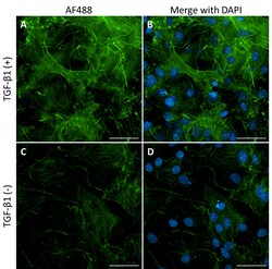 Biolegend&nbsp;Alexa Fluor 488 anti-α Smooth Muscle Actin [1A4]; Isotype: Mouse IgG2a, κ; Reactivity: Human, Mouse; Apps: IHC-P, ICC; Size: 25 μg