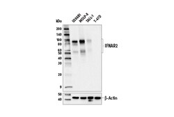 Cell Signaling Technology&nbsp;IFNAR2 E7Z4M Rabbit mAb 100