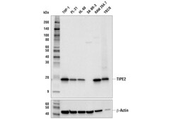 Cell Signaling Technology&nbsp;TIPE2 E5Q2S Rabbit mAb 100 u