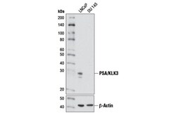Cell Signaling Technology&nbsp;PSA/KLK3 D6B1 XP R  Rabbit