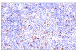 Cell Signaling Technology&nbsp;CTLA-4 E2V1Z Rabbit mAb 20 u