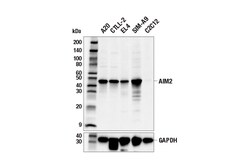Cell Signaling Technology&nbsp;AIM2 E5I8Z Rabbit mAb 100 ul