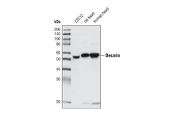 Cell Signaling Technology&nbsp;Desmin D93F5 XPR Rabbit mA