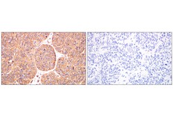 Cell Signaling Technology ILK1 4G9 Rabbit mAb BSA and
