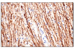 Cell Signaling Technology&nbsp;Neurofilament-M E7Y8W Mouse