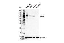 Cell Signaling Technology&nbsp;RANK E2N2Y Rabbit mAb 100 ul