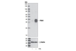 Cell Signaling Technology&nbsp;FRA1 D80B4 Rabbit mAb 20 ul