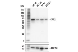 Cell Signaling Technology&nbsp;CPT2 E7D4W Rabbit mAb 100 ul
