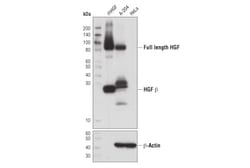 Cell Signaling Technology&nbsp;HGF beta D6S7D XPR Rabbit