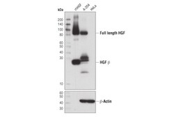 Cell Signaling Technology&nbsp;HGF beta D6S7D XPR Rabbit