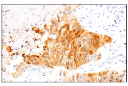 Cell Signaling Technology&nbsp;SERPINB3 OTI1A12 Mouse mAb 1