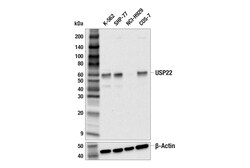 Cell Signaling Technology&nbsp;USP22 F4M4V Rabbit mAb 100 u