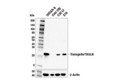 Cell Signaling Technology&nbsp;Transgelin/TAGLN E6Y8S Rabbi