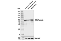 Cell Signaling Technology&nbsp;beta-2A-Tubulin Antibody 100 u