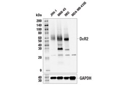 Cell Signaling Technology&nbsp;DcR2 E5X3W Rabbit mAb 100 ul