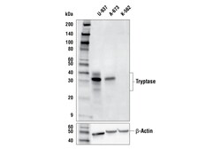 Cell Signaling Technology&nbsp;Tryptase E9R8A Rabbit mAb 10