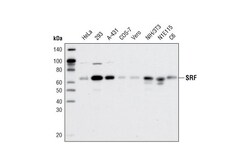 Cell Signaling Technology&nbsp;SRF D71A9 XPR Rabbit mAb 2