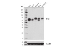 Cell Signaling Technology TFEB D2O7D Rabbit mAb BSA a