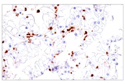 Cell Signaling Technology CEACAM6 E7S7Y Rabbit mAb BS