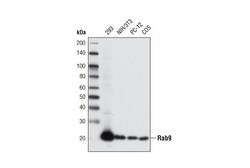 Cell Signaling Technology&nbsp;Rab9A D52G8 XPR Rabbit mAb