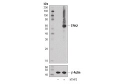 Cell Signaling Technology&nbsp;TPH2 D3E5I XPR Rabbit mAb
