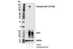 Cell Signaling Technology&nbsp;Phospho-ULK1 Thr180 E4N8N