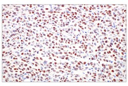 Cell Signaling Technology&nbsp;TWIST1 E2M5V Rabbit mAb 100