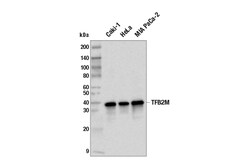 Cell Signaling Technology&nbsp;TFB2M E5P6W Rabbit mAb 100 u
