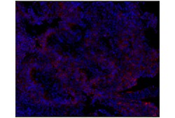 Cell Signaling Technology&nbsp;NCAM1 CD56 E7X9M XPR Rab