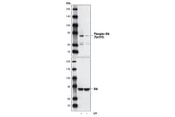 Cell Signaling Technology&nbsp;Phospho-Btk Tyr223 Antibody