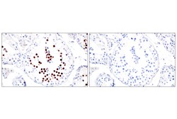 Cell Signaling Technology&nbsp;SGO2 E9K4N Rabbit mAb 100 ul