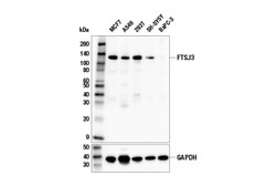 Cell Signaling Technology&nbsp;FTSJ3 E6T9J Rabbit mAb 100 u