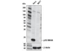 Cell Signaling Technology p16 INK4A D7C1M Rabbit mAb