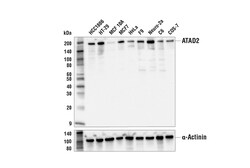 Cell Signaling Technology&nbsp;ATAD2 E8Y7F Rabbit mAb 100 u