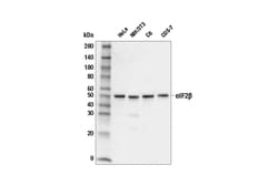 Cell Signaling Technology&nbsp;eIF2-beta Antibody 100 ul