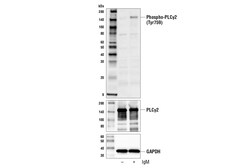 Cell Signaling Technology&nbsp;Phospho-PLC-gamma-2 Tyr759