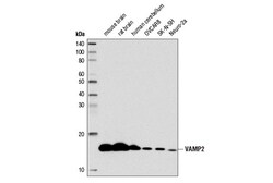 Cell Signaling Technology VAMP2 D6O1A Rabbit mAb BSA