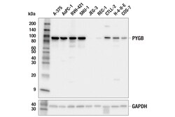 Cell Signaling Technology&nbsp;PYGB E3W5W Rabbit mAb 100 ul