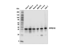 Cell Signaling Technology&nbsp;RPRD1B E8J9U Rabbit mAb 100