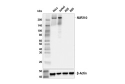 Cell Signaling Technology&nbsp;NUP210 E9A5G Rabbit mAb 100