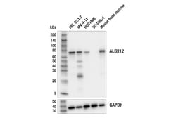 Cell Signaling Technology&nbsp;ALOX12 E3O9P Rabbit mAb 100