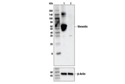 Cell Signaling Technology&nbsp;Vimentin V9 Mouse mAb 100 ug
