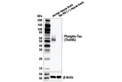 Cell Signaling Technology Phospho-Tau Thr205 E7D3E R