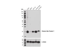 Cell Signaling Technology&nbsp;Visinin-Like Protein 1 D9L6L