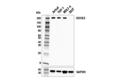 Cell Signaling Technology&nbsp;DOCK2 E7X1P Rabbit mAb 100 u